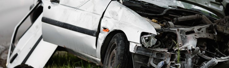 When 
      To Hire An Attorney After A Car Accident Kentfield 
      CA 94914